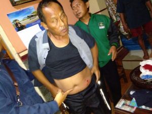 Perampok Beraksi di Sungkai Utara, Satu Peluru Lukai Korban