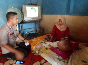 Tali Asih Kapolres Lampura untuk Balita Adrian