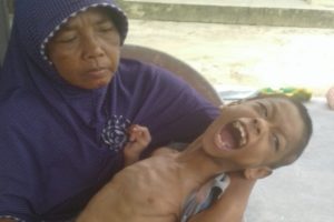 Slamet, Bocah 13 Tahun, Tergolek Lemah Butuh Bantuan Dermawan