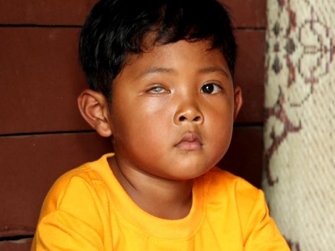 “Jiwaku Penolong”, Kapolres Tanggamus Salurkan Bantuan Kapolda Lampung Untuk Anak Penderita Kelainan Mata